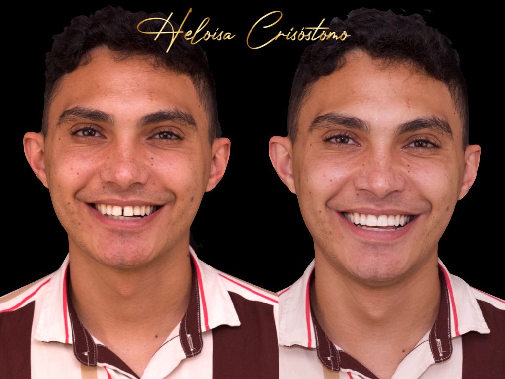 Resultado Dental Concept 4